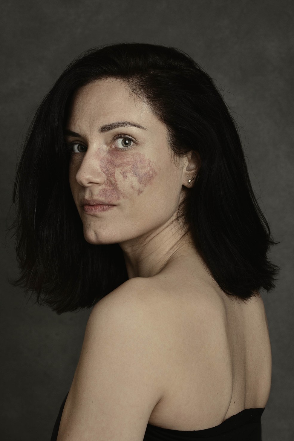 beautiful faces facial difference photo project